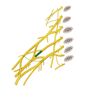 Posterior division of middle trunk of brachial plexus (#20600)