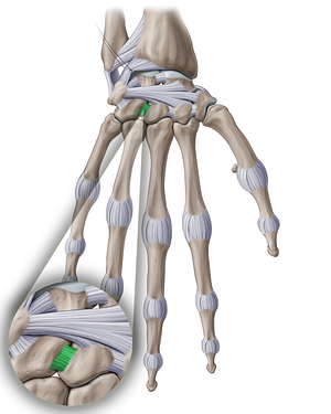 Capitohamate interosseous ligament (#18897)