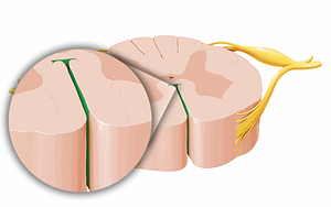 Anterior median fissure of spinal cord (#12026)