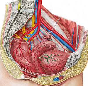 Right superior vesical artery (#1989)