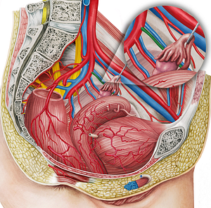 Left obturator artery (#1557)