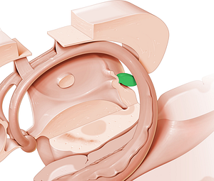 Pineal gland (#4089)