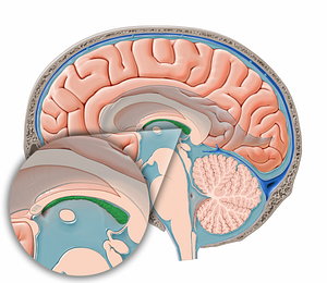Choroid plexus of third ventricle (#12072)