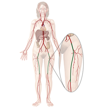 Femoral artery (#1246)