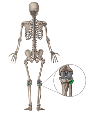 Superior tibiofibular joint (#2098)