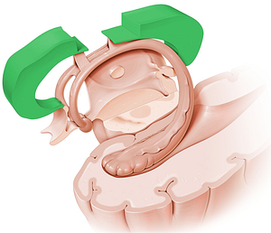 Corpus callosum (#2895)