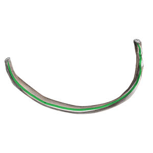 Superior attachment of innermost intercostal muscle of rib (#21735)