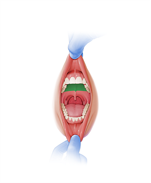 Hard palate (#7587)