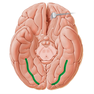 Midfusiform sulcus (#19603)
