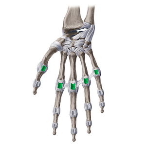 Palmar metacarpophalangeal ligaments (#19991)