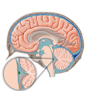 Lateral aperture of fourth ventricle (#15826)