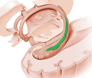 Fimbria of hippocampus (#3648)