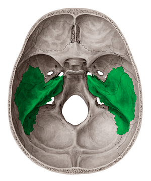 Temporal bone (#7522)