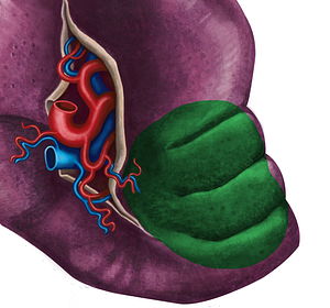 Colic impression of spleen (#3487)