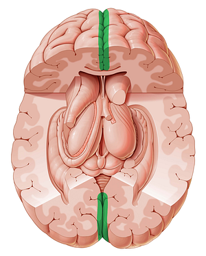 Longitudinal cerebral fissure (#3660)