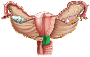 Cervix of uterus (#2580)