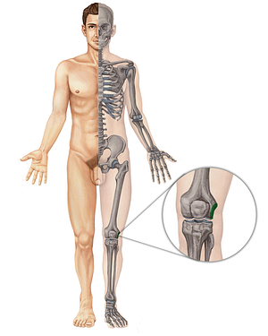 Lateral epicondyle of femur (#3395)