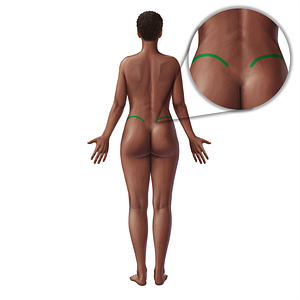 Iliac crest (#21032)