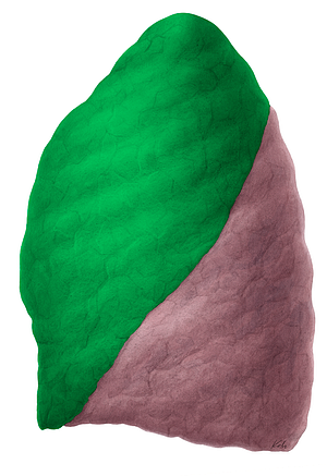 Superior lobe of left lung (#4863)