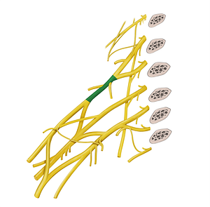 Superior trunk of brachial plexus (#9642)