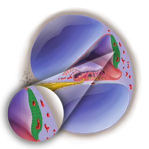 Stria vascularis of cochlear duct (#19044)