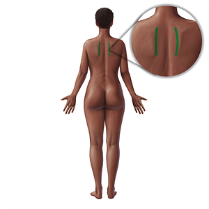 Medial border of scapula (#21030)