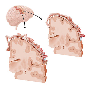 Motor and sensory cortical homunculus (Portuguese)