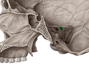 External opening of vestibular aqueduct (#749)