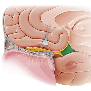 Anterior perforated substance (#9207)
