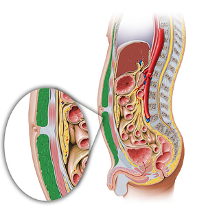 Fatty layer of subcutaneous tissue (Camper's fascia) (#7617)
