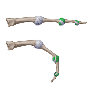 Accessory collateral interphalangeal ligaments of hand (#20759)