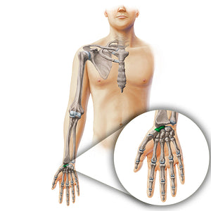 Scaphoid bone (#19878)