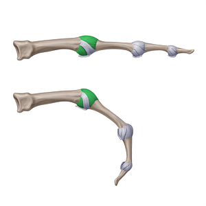Accessory collateral metacarpophalangeal ligaments (#20946)