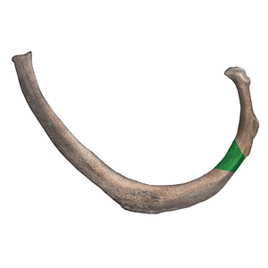 Angle of 2nd rib (#13)