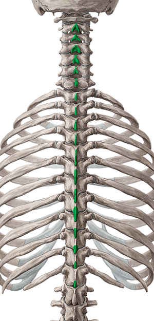 Spinous processes of vertebrae C2-T12 (#8249)
