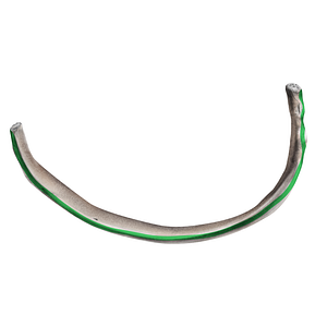 Superior attachment of internal intercostal muscle of rib (#21734)