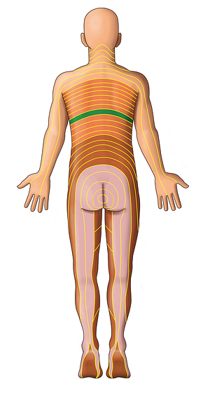 T8 dermatome (#13055)