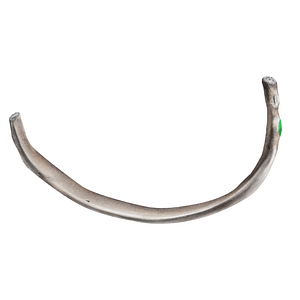 Tubercle of rib (#21722)