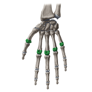 Head of metacarpal bone (#20092)