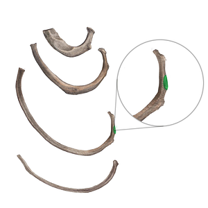 Articular facet on tubercle of rib (#41)