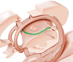 Hypothalamic sulcus (#9262)