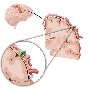 Motor cortex of brow (#11068)