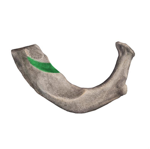 Groove for subclavian vein of 1st rib (#9346)