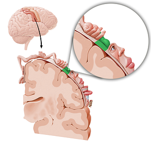 Sensory cortex of thumb (#11062)