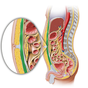 Rectus abdominis muscle (#5834)