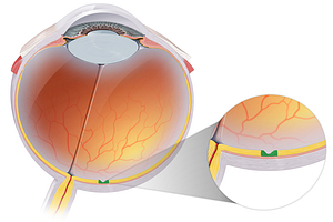 Fovea centralis (#3900)