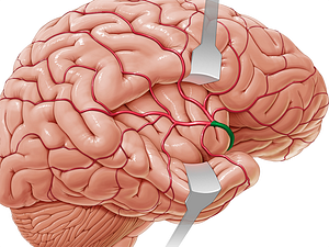 Middle cerebral artery (#1016)