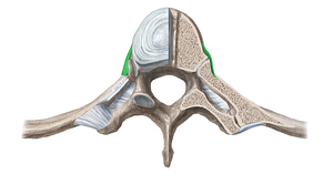 Radiate ligament of head of rib (#11383)
