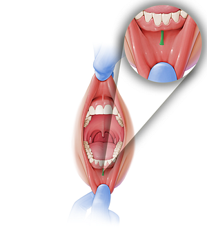 Frenulum of lower lip (#3913)