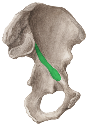 Arcuate line of ilium (#4699)